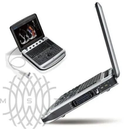 УЗИ аппарат Chison SonoTouch 80 Expert портативный