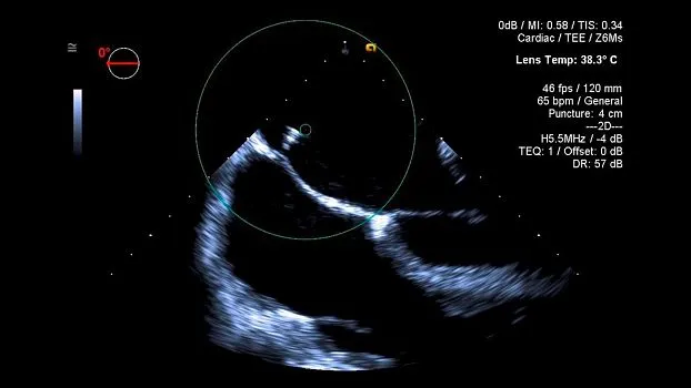 Клинические изображения Siemens Acuson SC2000 ультразвуковая система