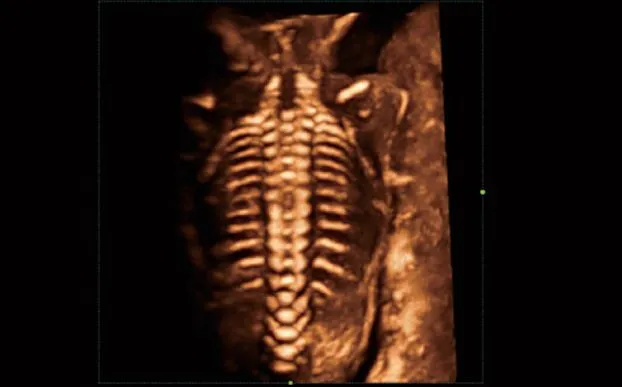 Клинические изображения УЗИ аппарат Mindray Imagyn I9