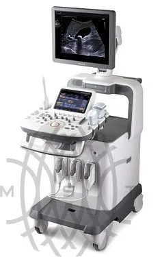 Samsung Medison Accuvix XG УЗИ аппарат