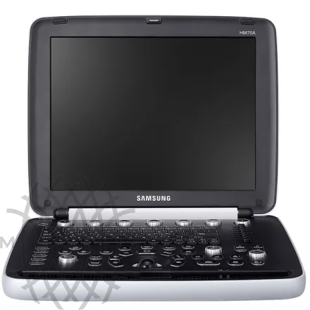 Samsung Medison HM70A УЗИ аппарат портативный
