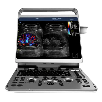 Ультразвуковой аппарат Chison EBit 50
