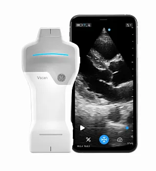 УЗИ аппарат GE HealthCare Vscan Air карманный