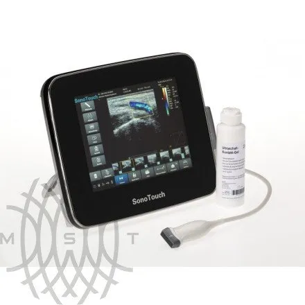 Chison SonoTouch 30 портативный УЗИ аппарат