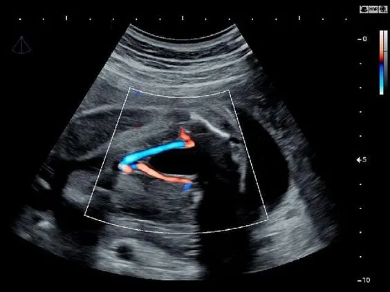 Клинические изображения УЗИ аппарат НПО СКАНЕР РУСКАН 60