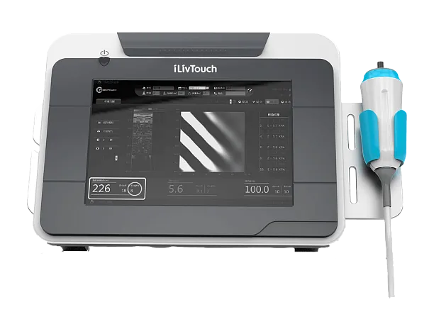 УЗИ аппарат iLivTouch FT 200