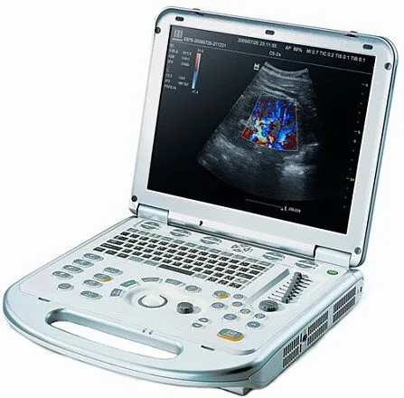 УЗИ аппарат Mindray M7 портативный