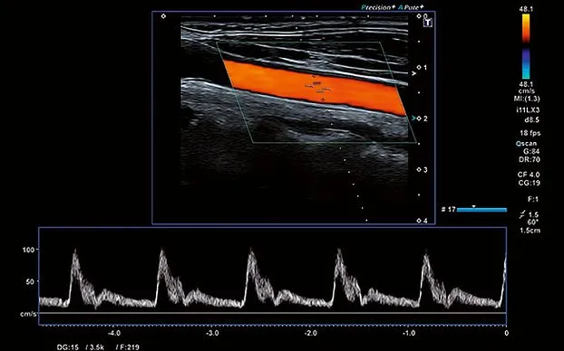 Клинические изображения Canon (Toshiba) Aplio i800 аппарат УЗИ