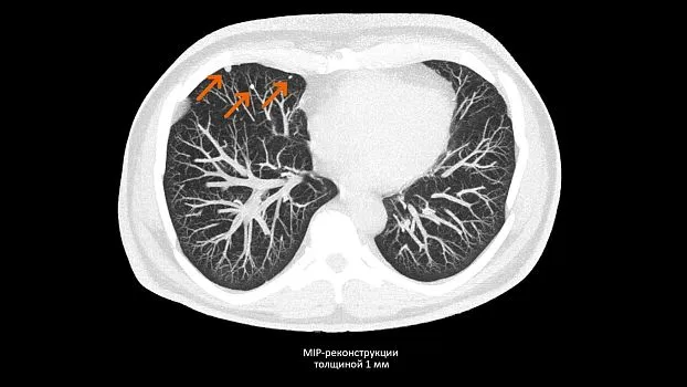 Клинические изображения Siemens SOMATOM go.Up компьютерный томограф