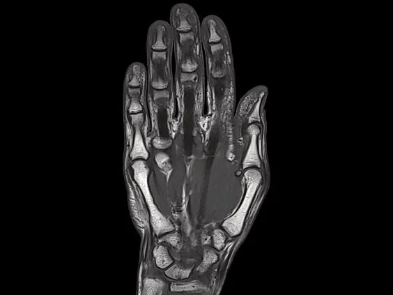 Клинические изображения Магнитно-резонансный томограф Siemens MAGNETOM Skyra 3T