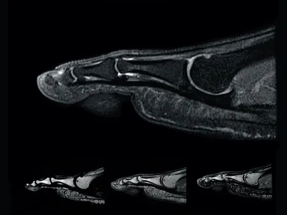 Клинические изображения Магнитно-резонансный томограф GE HealthCare Optima MR450w