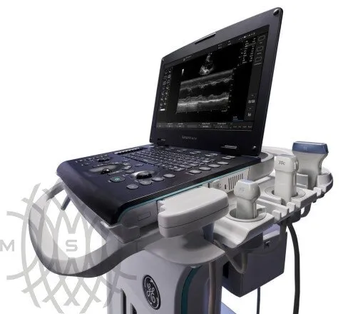 УЗИ аппарат GE Healthcare Versana Active портативный