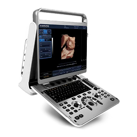 Chison EBit 30 ультразвуковой аппарат