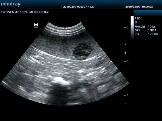 Клинические изображения УЗИ аппарат Mindray DP-50 Vet ветеринарный портативный