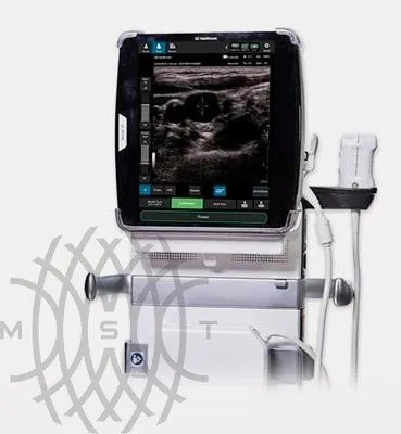 GE Venue 50 аппарат УЗИ портативный