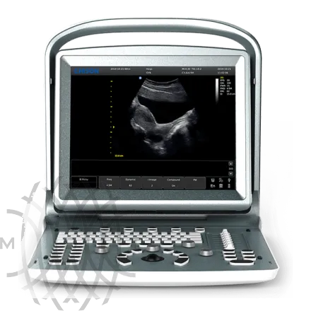 Chison SonoTouch 20 УЗИ аппарат портативный