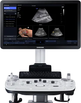 Samsung Medison HS30 УЗИ аппарат