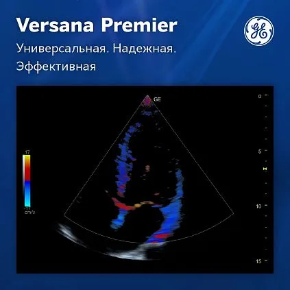 Клинические изображения Versana Premier Black GE Healthcare