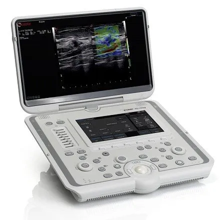 УЗИ аппарат Esaote MyLab Omega