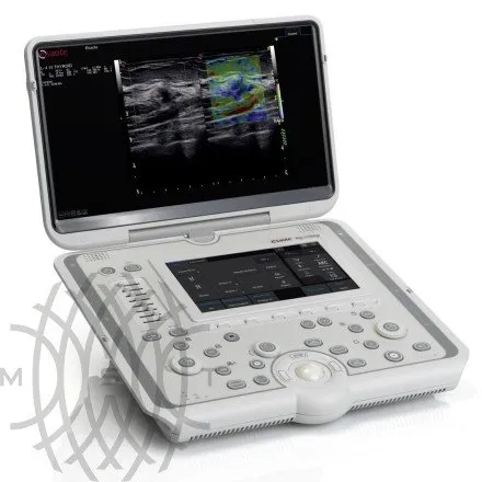 УЗИ аппарат Esaote MyLab Omega