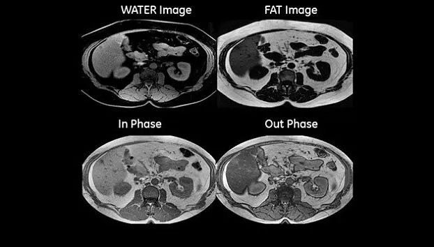 Клинические изображения МРТ аппарат GE SIGNA Explorer 1.5T