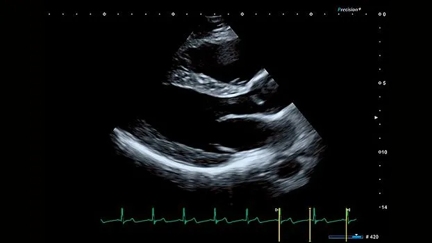 Клинические изображения Canon (Toshiba) Aplio i900 аппарат УЗИ