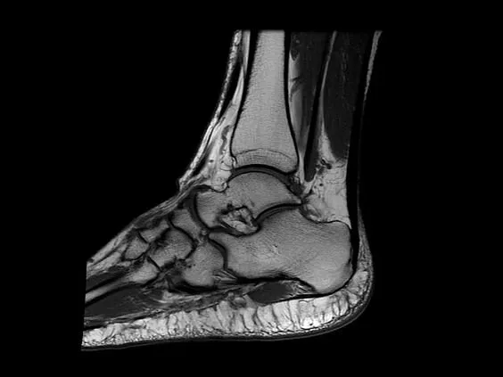 Клинические изображения МРТ аппарат GE SIGNA Explorer 1.5T