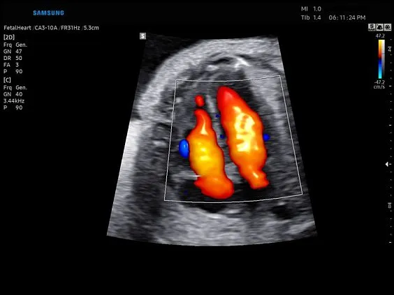 Клинические изображения Samsung Medison W9 УЗИ аппарат