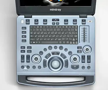 УЗИ аппарат Mindray M8 портативный
