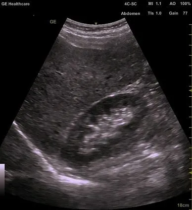 Клинические изображения GE Venue 50 аппарат УЗИ портативный