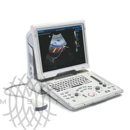 УЗИ аппарат Mindray Z5 портативный