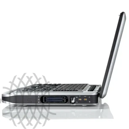 УЗИ аппарат Chison SonoTouch 80 портативный