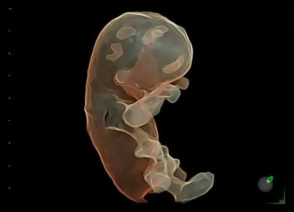 Клинические изображения Ультразвуковая диагностическая система GE HealthCare Voluson E6