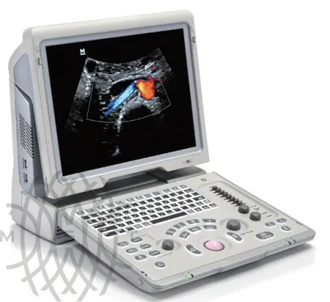 УЗИ аппарат Mindray Z6 портативный