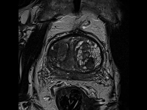 Клинические изображения Магнитно-резонансный томограф Siemens MAGNETOM Skyra 3T