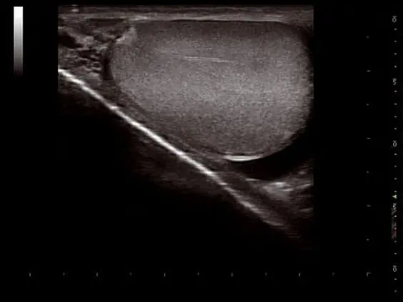 Клинические изображения УЗИ аппарат Esaote MyLab Twice