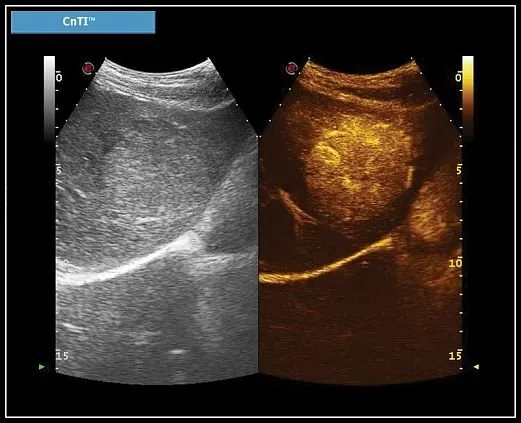 Клинические изображения УЗИ аппарат Esaote MyLab X7