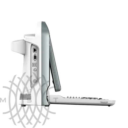 Chison SonoTouch 20 УЗИ аппарат портативный