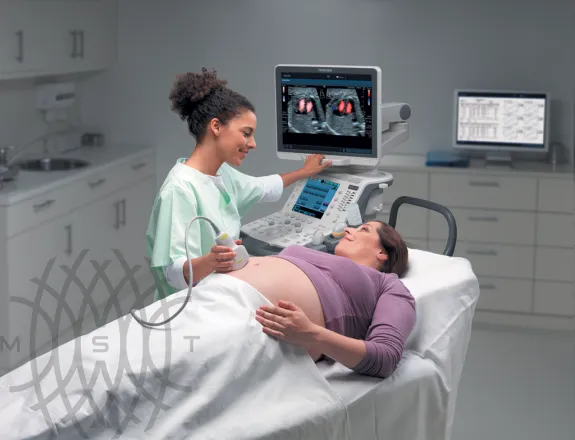 Canon (Toshiba) Aplio 300 УЗИ аппарат