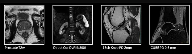 Клинические изображения МРТ аппарат GE SIGNA Pioneer 3T