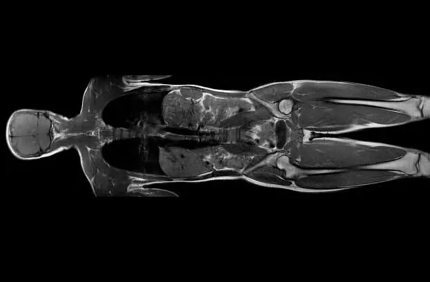 Клинические изображения МРТ аппарат GE SIGNA Creator 1.5T