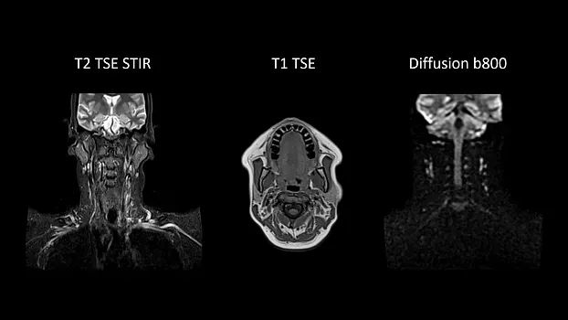 Клинические изображения Магнитно-резонансный томограф Siemens MAGNETOM Free.Max