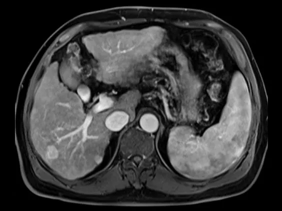 Клинические изображения Магнитно-резонансный томограф Siemens MAGNETOM Skyra 3T