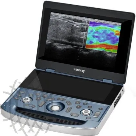 УЗИ аппарат Mindray MX7 Exp портативный