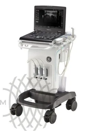УЗИ аппарат GE Healthcare Versana Active портативный