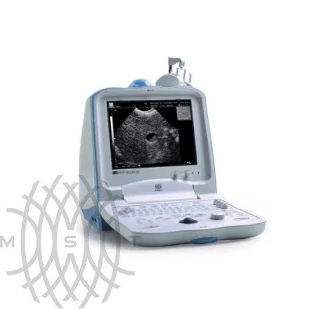 УЗИ аппарат Mindray DP 3300