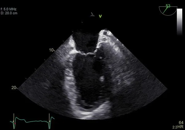 Клинические изображения УЗИ аппарат GE HealthCareVivid E90