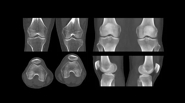 Клинические изображения GE HealthCare Revolution EVO компьютерный томограф