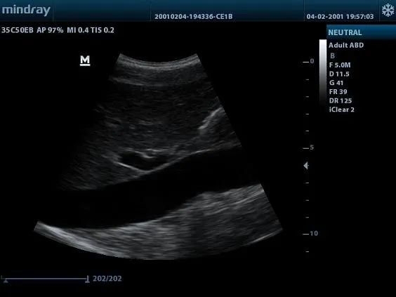 Клинические изображения УЗИ аппарат Mindray DP-20 Vet ветеринарный портативный