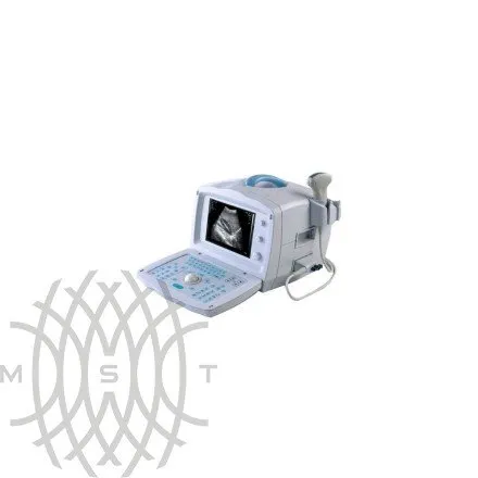 УЗИ аппарат Mindray DP 1100 портативный